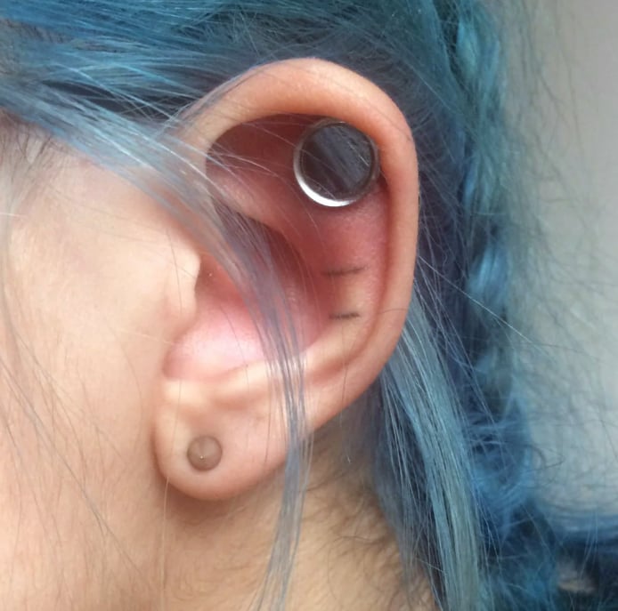 dermal punch in ear