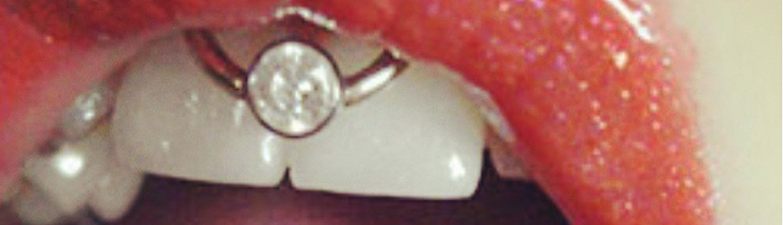 Keep Your Smile On The Down Low The Incognito Smiley Piercing Freshtrends Body Jewelry Blog